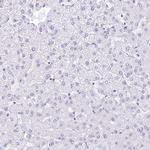 HNRNPA0 Antibody in Immunohistochemistry (Paraffin) (IHC (P))