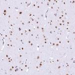 HNRNPA0 Antibody in Immunohistochemistry (IHC)