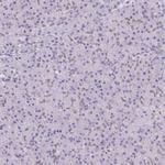 HNRNPA0 Antibody in Immunohistochemistry (IHC)