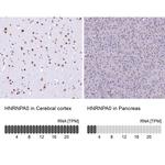 HNRNPA0 Antibody