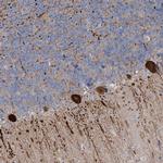 CMBL Antibody in Immunohistochemistry (Paraffin) (IHC (P))