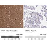 TPPP Antibody in Immunohistochemistry (IHC)