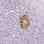 TPPP Antibody in Immunohistochemistry (IHC)