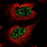 DPCD Antibody in Immunocytochemistry (ICC/IF)