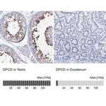 DPCD Antibody