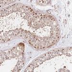 PPP2R5B Antibody in Immunohistochemistry (IHC)