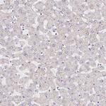 PPP2R5B Antibody in Immunohistochemistry (IHC)