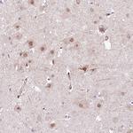 PPP2R5B Antibody in Immunohistochemistry (IHC)