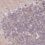 PPP2R5B Antibody in Immunohistochemistry (IHC)