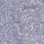 FAM76B Antibody in Immunohistochemistry (Paraffin) (IHC (P))