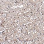 ARHGAP21 Antibody in Immunohistochemistry (Paraffin) (IHC (P))