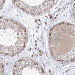 ARHGAP21 Antibody in Immunohistochemistry (Paraffin) (IHC (P))