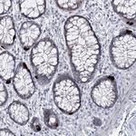 RBM15B Antibody in Immunohistochemistry (Paraffin) (IHC (P))