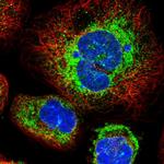 STT3B Antibody in Immunocytochemistry (ICC/IF)