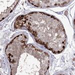 STT3B Antibody in Immunohistochemistry (Paraffin) (IHC (P))