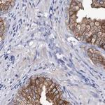 UGDH Antibody in Immunohistochemistry (IHC)