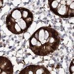 UGDH Antibody in Immunohistochemistry (IHC)