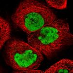 PDS5A Antibody in Immunocytochemistry (ICC/IF)