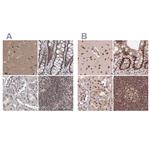 PDS5A Antibody in Immunohistochemistry (IHC)