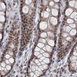 PDS5A Antibody in Immunohistochemistry (IHC)