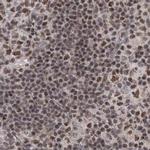 PDS5A Antibody in Immunohistochemistry (IHC)