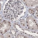 PDS5A Antibody in Immunohistochemistry (IHC)