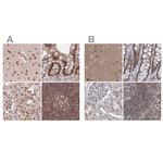 PDS5A Antibody in Immunohistochemistry (IHC)