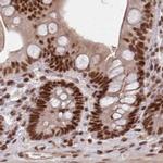 PDS5A Antibody in Immunohistochemistry (IHC)