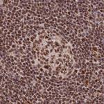 PDS5A Antibody in Immunohistochemistry (IHC)