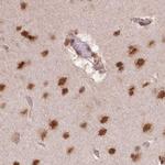 PDS5A Antibody in Immunohistochemistry (IHC)