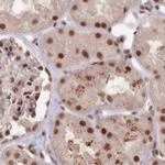 PDS5A Antibody in Immunohistochemistry (IHC)