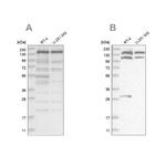 PDS5A Antibody in Western Blot (WB)