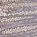 DHRS9 Antibody in Immunohistochemistry (Paraffin) (IHC (P))