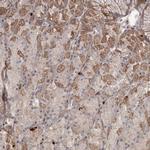 DHRS9 Antibody in Immunohistochemistry (Paraffin) (IHC (P))