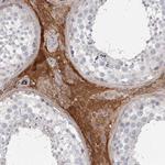 DHRS9 Antibody in Immunohistochemistry (Paraffin) (IHC (P))