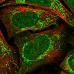 RG9MTD1 Antibody in Immunocytochemistry (ICC/IF)