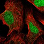 FARSB Antibody in Immunocytochemistry (ICC/IF)