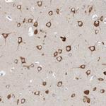 FARSB Antibody in Immunohistochemistry (Paraffin) (IHC (P))