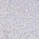 FARSB Antibody in Immunohistochemistry (Paraffin) (IHC (P))