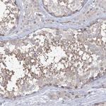 FARSB Antibody in Immunohistochemistry (Paraffin) (IHC (P))