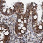 SUCLG1 Antibody in Immunohistochemistry (IHC)