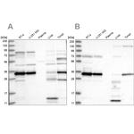 SUCLG1 Antibody in Western Blot (WB)