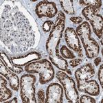 SUCLG1 Antibody in Immunohistochemistry (IHC)