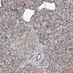 SUCLG1 Antibody in Immunohistochemistry (IHC)