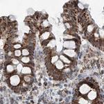 SUCLG1 Antibody in Immunohistochemistry (IHC)