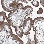 FANCL Antibody in Immunohistochemistry (Paraffin) (IHC (P))