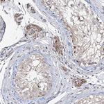 FANCL Antibody in Immunohistochemistry (Paraffin) (IHC (P))