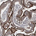 FANCL Antibody in Immunohistochemistry (IHC)