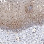 INPP1 Antibody in Immunohistochemistry (Paraffin) (IHC (P))