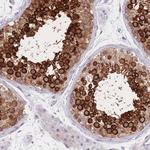 Adenylate Kinase 9 Antibody in Immunohistochemistry (Paraffin) (IHC (P))